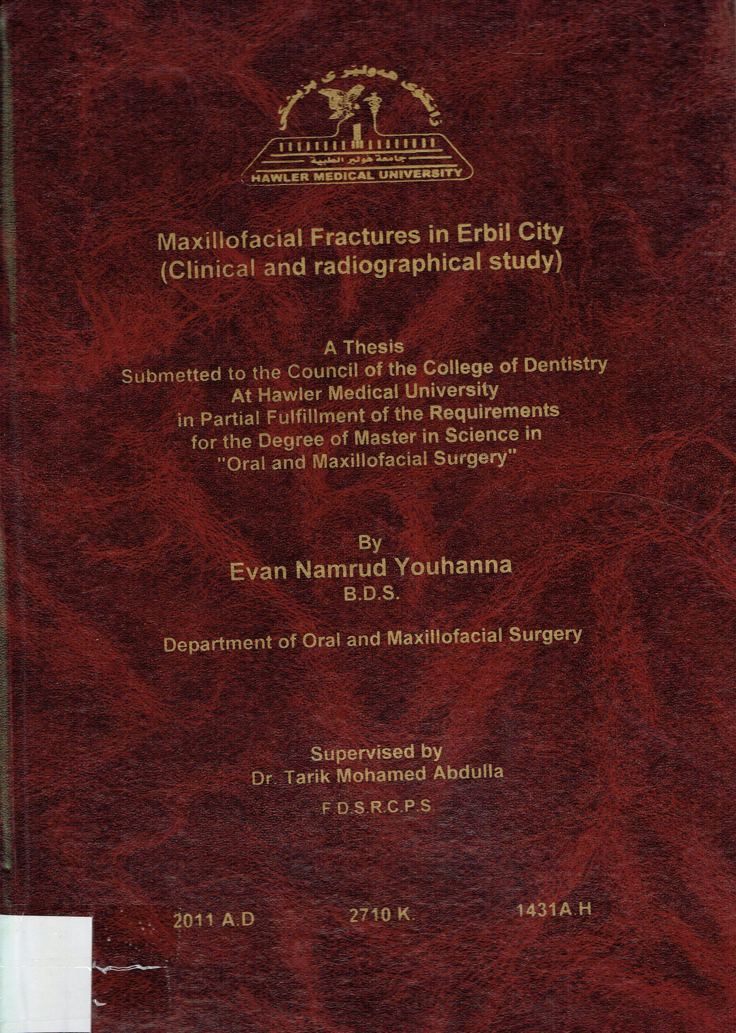 Maxillofacial Fractures in Erbil City  (Clinical and radiographical Study)